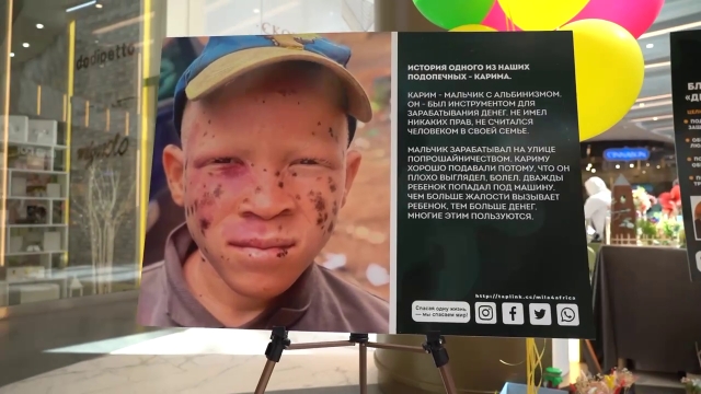 <i>В Грозном устроили акцию в поддержку детей-альбиносов из Африки</i>