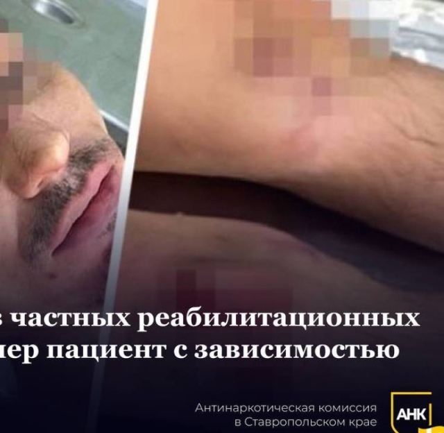 <i>Бастрыкин затребовал доклад об истязании пациента в рехабе Пятигорска</i>